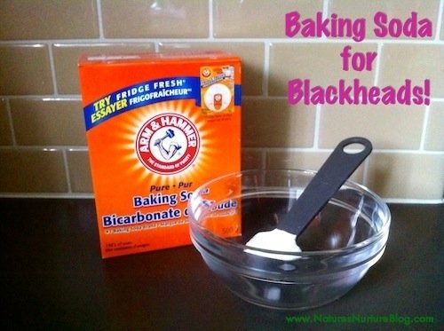 baking soda for blackheads