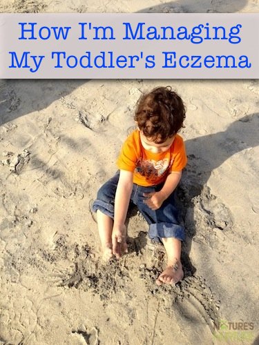 Eczema in Toddlers