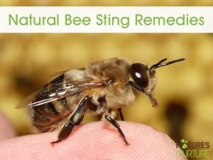 Natural Bee Sting Remedies